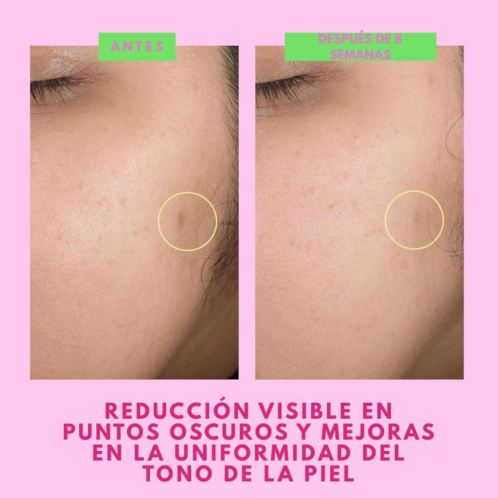 B-Goldi™ - Gotas iluminadoras enriquecidas con niacinamida ·  Drunk Elephant