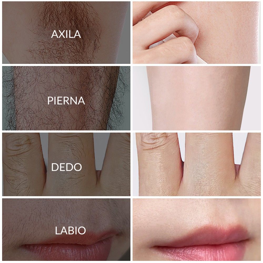 PHOFAY — Crema depilatoria indolora para piel sensible