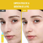 PHOFAY — Peeling suave enzimático · Papaya + AHA + BHA