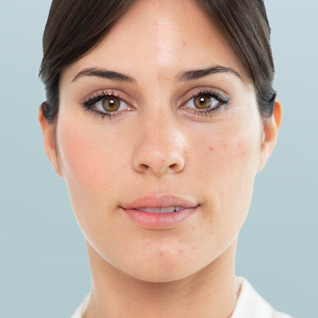 Moispa™ Sauna Facial Eléctrica - InnovaGoods