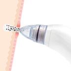 Pore·Off — Limpiador Facial Eléctrico de Puntos Negros · InnovaGoods